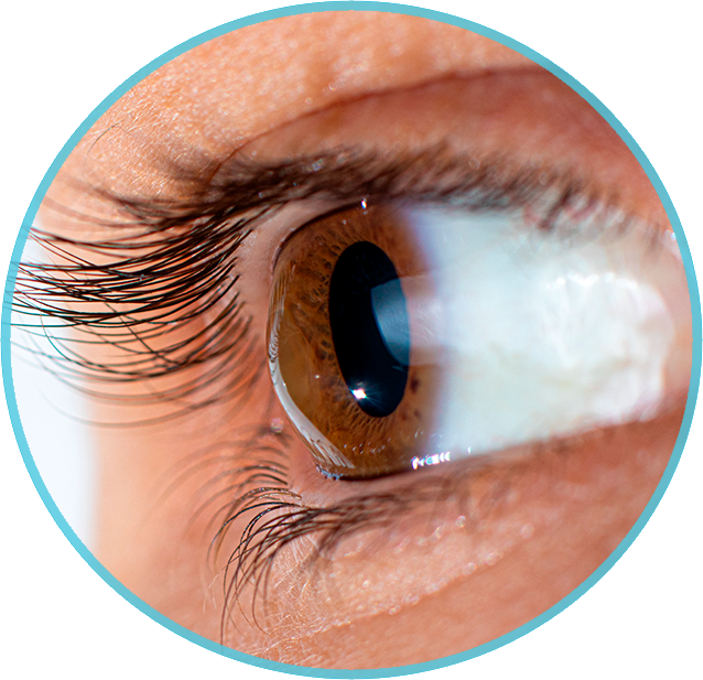 Ficar cego: temor relacionado ao ceratocone - Instituto de Moléstias  Oculares